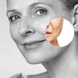 Derma SR-Mikroneulaus - Monipuolinen ja Tehokas Hoito