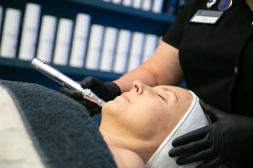 Derma SR-Mikroneulaus - Monipuolinen ja Tehokas Hoito